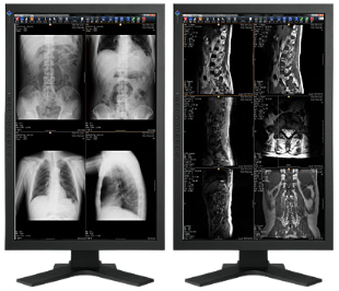 プリズムメディカル社製品イメージ